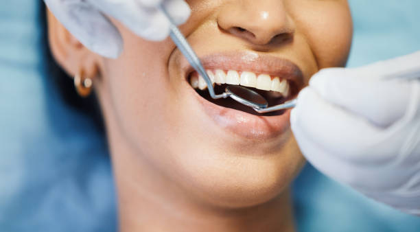 Best Emergency Dentist for Knocked-Out Tooth in Harrisonville, MO